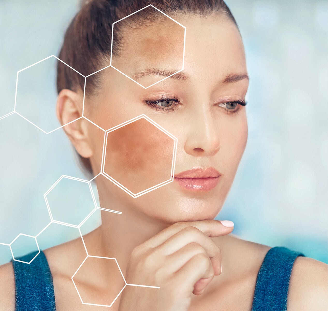 How does Skin whitening work?.