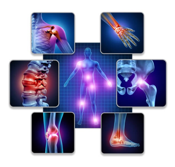 Joint Health and Recovery: Solutions Available at Supps247.