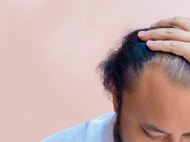 How to avoid Hair loss.